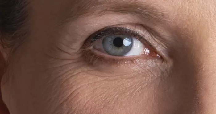 astuces-naturelles-efficaces-contre-les-rides