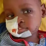 affaire-une-famille-mordue-par-un-chien-de-garde-a-marcory-ce-que-risquent-les-victimes-a-vie-le-maitre-chien-condamne-a-6-mois-de-prison