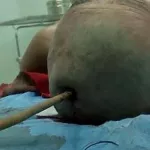 bingerville-un-footballeur-transperce-par-des-fers-a-beton-sur-le-chantier-de-construction-du-tribunal