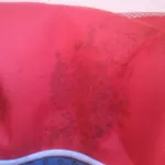 voici-comment-enlever-les-moisissures-avec-le-dentifrice-et-la-levure-sur-les-tissus