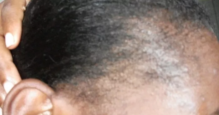 des-astuces-pour-avoir-une-belle-chevelure