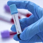 sante-un-pretre-denonce-la-mauvaise-gestion-de-la-crise-du-covid-19-en-cote-d-ivoire