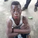 adjame-un-agresseur-de-sapeur-pompier-se-fait-administrer-un-soin-du-visage-a-la-caserne