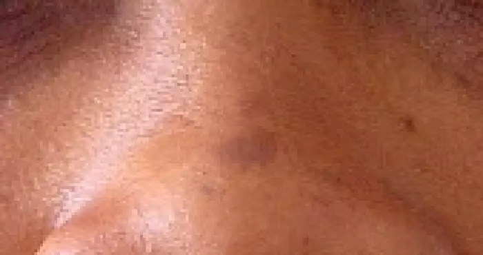 des-astuces-simples-pour-avoir-un-joli-nez