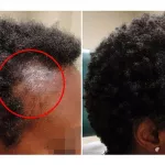 astuces-pour-lutter-contre-la-chute-des-cheveux