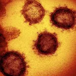 royaume-uni-elle-meurt-du-covid-19-apres-s-etre-fait-cracher-dessus