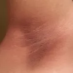 astuces-pour-avoir-des-aisselles-propres