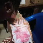 une-fille-de-11-ans-ebouillantee-par-sa-propre-mere-une-aide-est-souhaitee