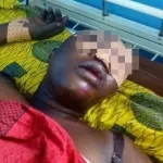 agboville-une-dame-sauvagement-battue-internee-au-chr-le-violent-conjoint-a-pris-la-fuite