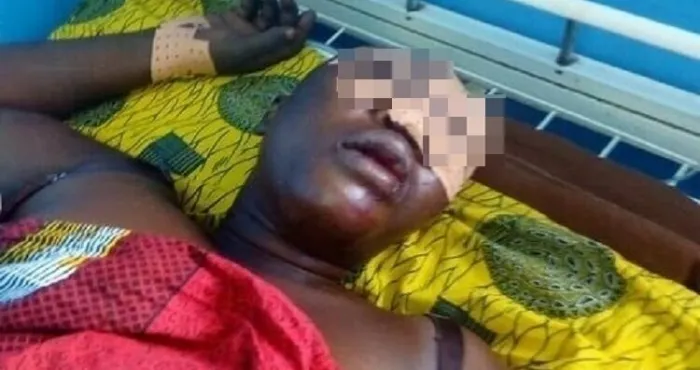 agboville-une-dame-sauvagement-battue-internee-au-chr-le-violent-conjoint-a-pris-la-fuite