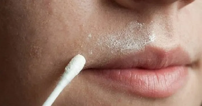 comment-se-debarrasser-des-poils-sur-le-visage-naturellement