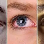 5-signes-que-vos-yeux-vous-envoient-pour-surveiller-votre-etat-de-sante