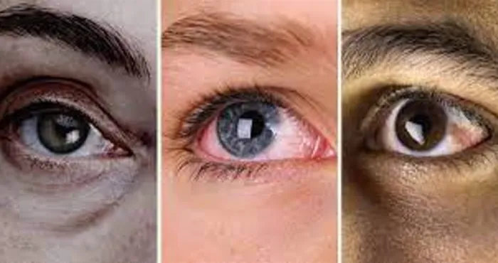 5-signes-que-vos-yeux-vous-envoient-pour-surveiller-votre-etat-de-sante