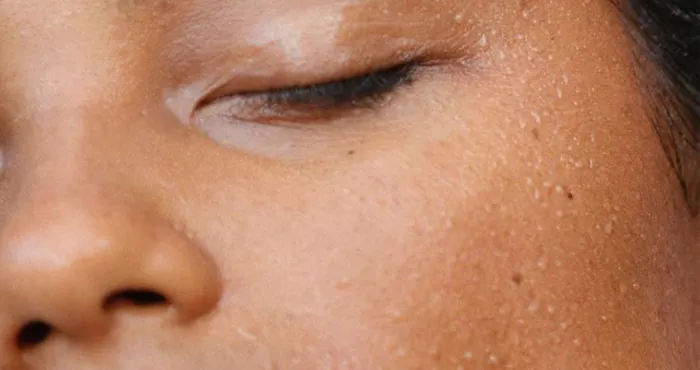 les-soins-qu-il-faut-a-votre-peau-selon-qu-elle-soit-seche-ou-grasse
