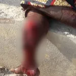 tanda-un-jeune-fusille-dans-la-jambe-apres-avoir-vole-un-porc-avec-ses-amis