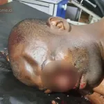 accident-corporel-de-la-circulation-a-odienne-un-gendarme-lutte-contre-la-mort-apres-avoir-percute-un-cheval-en-divagation