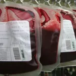produits-sanguins-voici-pourquoi-la-poche-de-sang-est-desormais-a-3000f