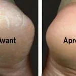 astuces-voici-les-bienfaits-du-bain-de-pieds-au-vinaigre-sur-votre-sante