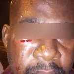 yamoussoukro-deux-hommes-armes-se-battent-a-un-corridor-l-un-des-deux-tente-d-arracher-son-arme-a-un-policier-et-le-blesse