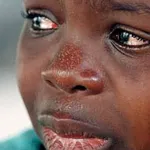 grand-lahou-une-eleve-de-3eme-souffre-d-un-kyste-au-bras-et-appelle-au-secours