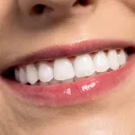 comment-avoir-un-sourire-parfait-quand-on-n-a-pas-de-belles-dents