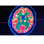 sante-covid-19-voici-ce-que-le-virus-pourrait-faire-sur-le-cerveau