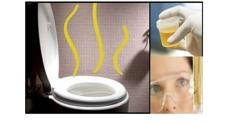 astuces-voici-ces-5-causes-pourraient-etre-la-raison-pour-laquelle-votre-urine-sent-mauvais