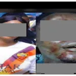 drame-une-serveuse-de-maquis-saisit-une-bouteille-et-tranche-la-gorge-de-son-collegue-dj-qui-voulait-la-violer