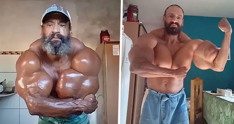 apres-s-etre-injecte-de-l-huile-dans-les-biceps-un-bodybuilder-bresilien-decede