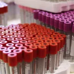 sante-5-bonnes-raisons-de-connaitre-son-groupe-sanguin