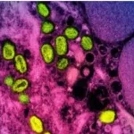 alerte-sante-premier-cas-de-la-variole-de-singe-en-chine-tout-contact-direct-avec-des-etrangers-deconseille