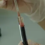 sante-ferritine-elevee-quelles-sont-les-causes