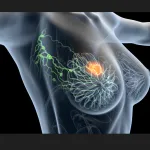 cancer-du-sein-ces-5-signes-qui-doivent-vous-alerter