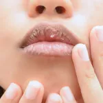 levres-seches-4-astuces-pour-en-finir