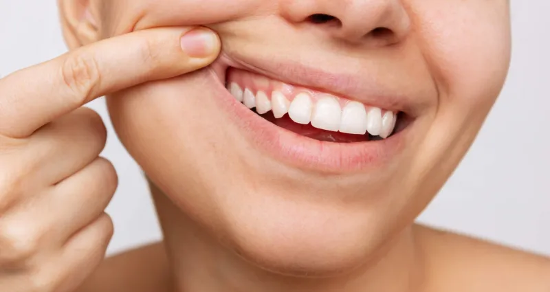 soin-bucco-dentaire-2-astuces-pour-prendre-soin-de-ses-gencives