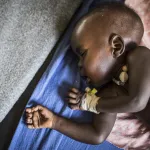 sante-appel-d-urgence-pour-30-millions-d-enfants-souffrant-de-malnutrition-aigue