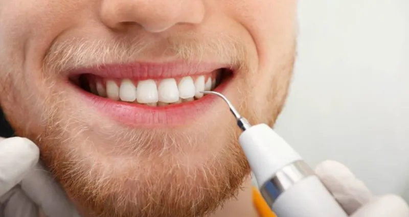 dents-saines-ecorces-d-orange-pour-retirer-le-tartre-dentaire-et-astuce-pour-les-prevenir