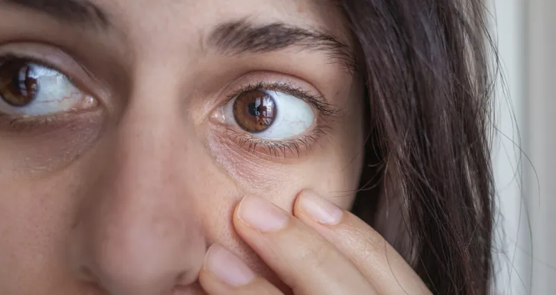 regard-fatigue-l-astuce-sans-maquillage-pour-eliminer-les-cernes