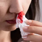 remedes-naturels-3-astuces-pour-vite-arreter-un-nez-qui-saigne