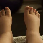 pieds-gonfles-5-bains-de-pieds-naturels-pour-les-faire-degonfler-illico