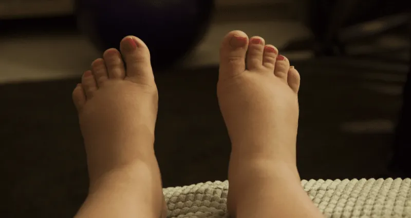 pieds-gonfles-5-bains-de-pieds-naturels-pour-les-faire-degonfler-illico