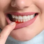 douleur-aux-gencives-voici-un-remede-secret-pour-des-gencives-parfaites