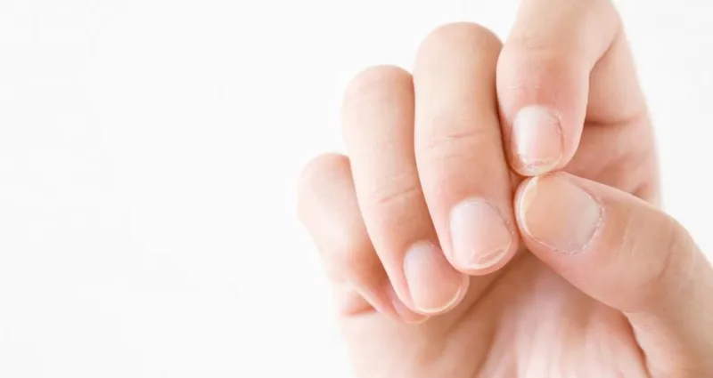 revelateurs-de-sante-ce-que-vos-ongles-disent-sur-vous