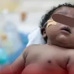 sante-une-fillette-de-5-mois-confrontee-a-un-probleme-du-foie-40-millions-recherchee-pour-l-operation