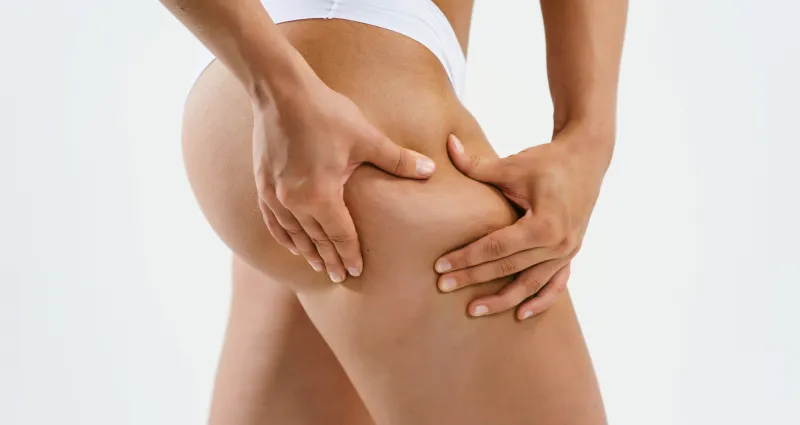 cellulites-la-methode-secrete-pour-une-peau-parfaite-en-5-minutes