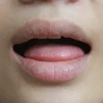 bouche-seche-dites-adieu-a-la-bouche-seche-avec-ces-7-remedes-naturels