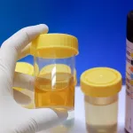 secrets-caches-ce-que-la-couleur-de-votre-urine-dit-vraiment-sur-votre-sante