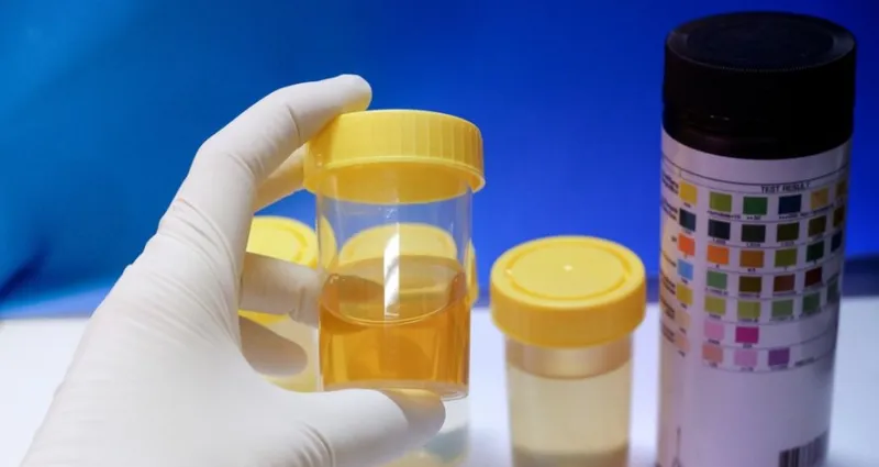 secrets-caches-ce-que-la-couleur-de-votre-urine-dit-vraiment-sur-votre-sante