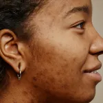 revelation-choquante-ces-7-aliments-que-vous-ne-devriez-jamais-manger-si-vous-voulez-une-peau-parfaite