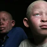 la-revue-de-l-actualite-internationale-les-albinos-a-la-une-journaliste-malien-enleve-blinken-a-gaza-sud